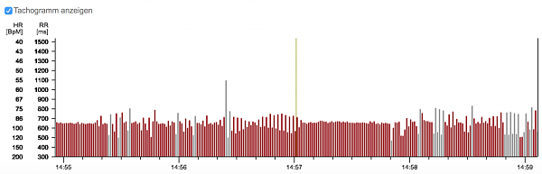 Klicke auf die Grafik fr eine vergrerte Ansicht

Name: Bildschirmfoto 2016-11-30 um 11.40.57.png
Ansichten: 450
Gre: 120,3 KB
ID: 707