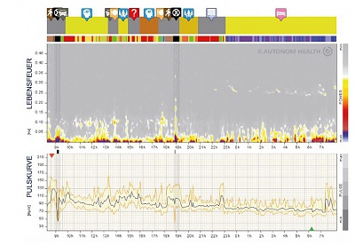 Klicke auf die Grafik für eine vergrößerte Ansicht  Name: Schilddrüsenunterfunktion vor Therapie.jpg Ansichten: 1 Größe: 171,4 KB ID: 864