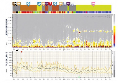 Klicke auf die Grafik für eine vergrößerte Ansicht  Name: erfolgreiche medikamentöse Intervention.jpg Ansichten: 1 Größe: 161,5 KB ID: 865