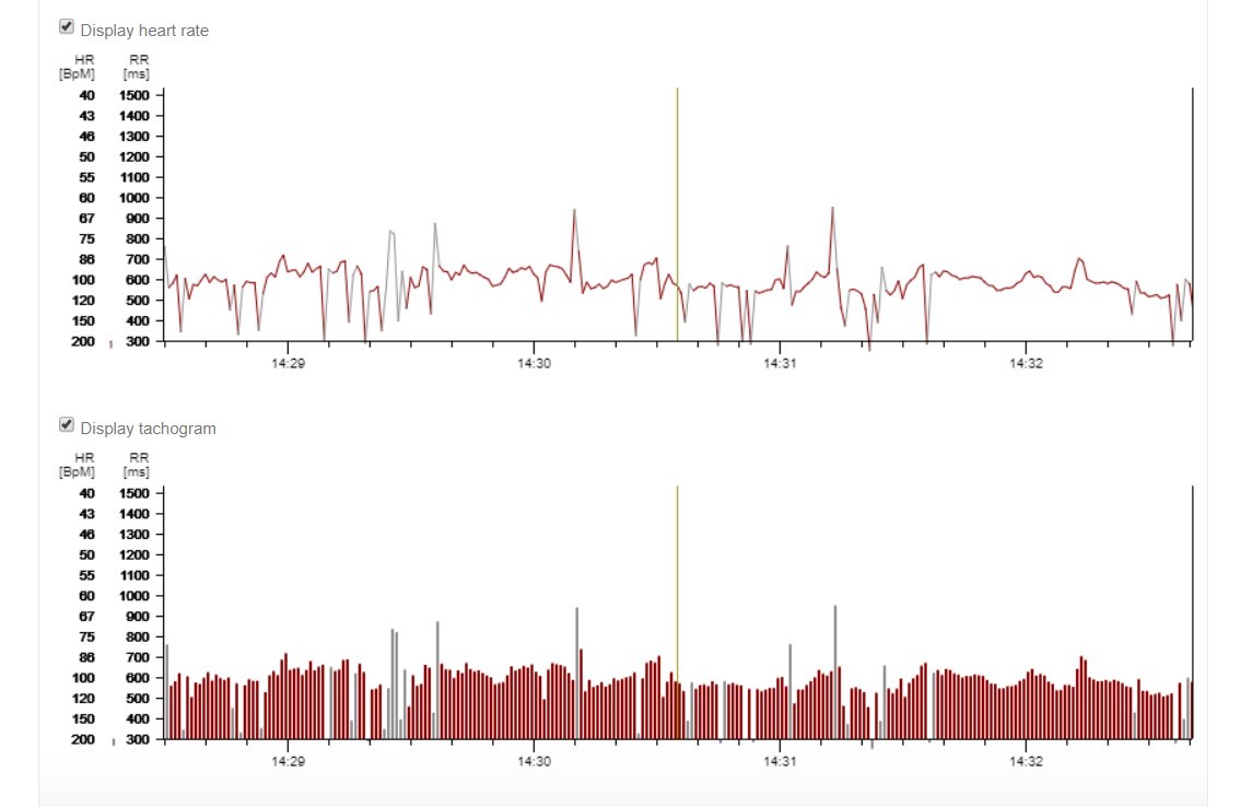 Klicke auf die Grafik fr eine vergrerte Ansicht

Name: gdj histogram.jpg
Ansichten: 124
Gre: 89,3 KB
ID: 1407