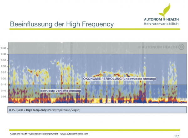 Klicke auf die Grafik für eine vergrößerte Ansicht  Name: High Frequency.png Ansichten: 1 Größe: 1,30 MB ID: 1509