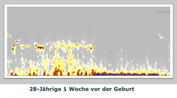 Klicke auf die Grafik für eine vergrößerte Ansicht  Name: 28-Jährige 1 Woche vor der Geburt.png Ansichten: 10 Größe: 319,9 KB ID: 3120