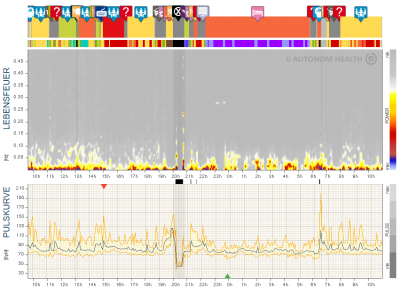 Beispielbild chronischer Stress, weiblich, 40.PNG