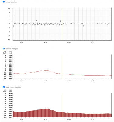 Klicke auf die Grafik für eine vergrößerte Ansicht  Name: Med-Abschnitt.png Ansichten: 0 Größe: 218,2 KB ID: 3349