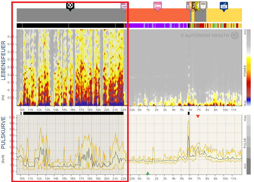 Klicke auf die Grafik fÃÂ¼r eine vergrÃÂ¶ÃÂerte Ansicht  Name: Artefakte im HRV Spektrogramm.png Ansichten: 0 GrÃÂ¶ÃÂe: 258,1 KB ID: 3425