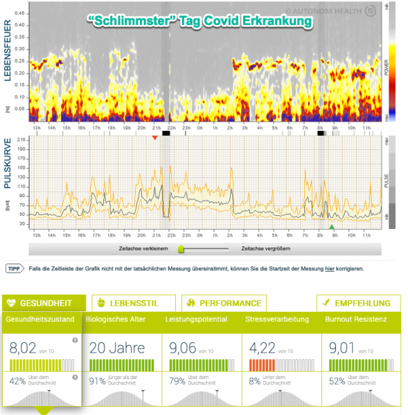 Klicke auf die Grafik fr eine vergrerte Ansicht

Name: Erkrankung.png
Ansichten: 226
Gre: 478,0 KB
ID: 3457