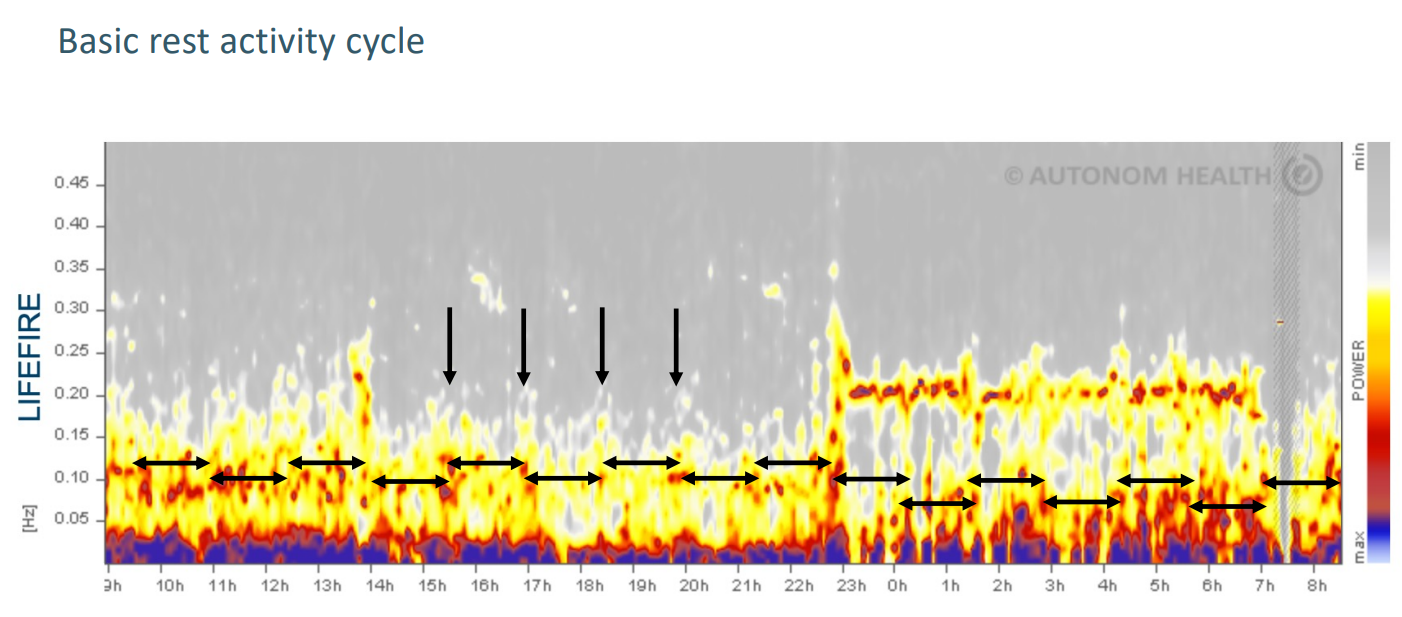Klicke auf die Grafik fr eine vergrerte Ansicht

Name: BRAC_2.png
Ansichten: 99
Gre: 561,9 KB
ID: 3521
