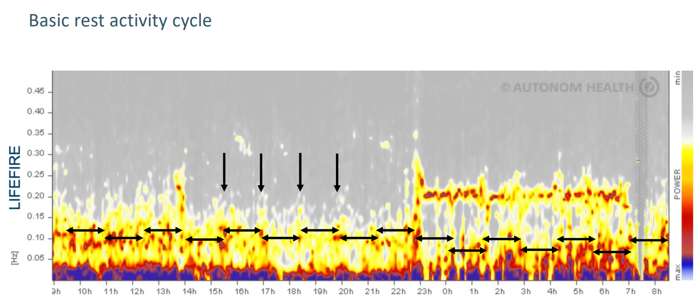 Klicke auf die Grafik fr eine vergrerte Ansicht

Name: BRAC_2.png
Ansichten: 90
Gre: 561,9 KB
ID: 3521