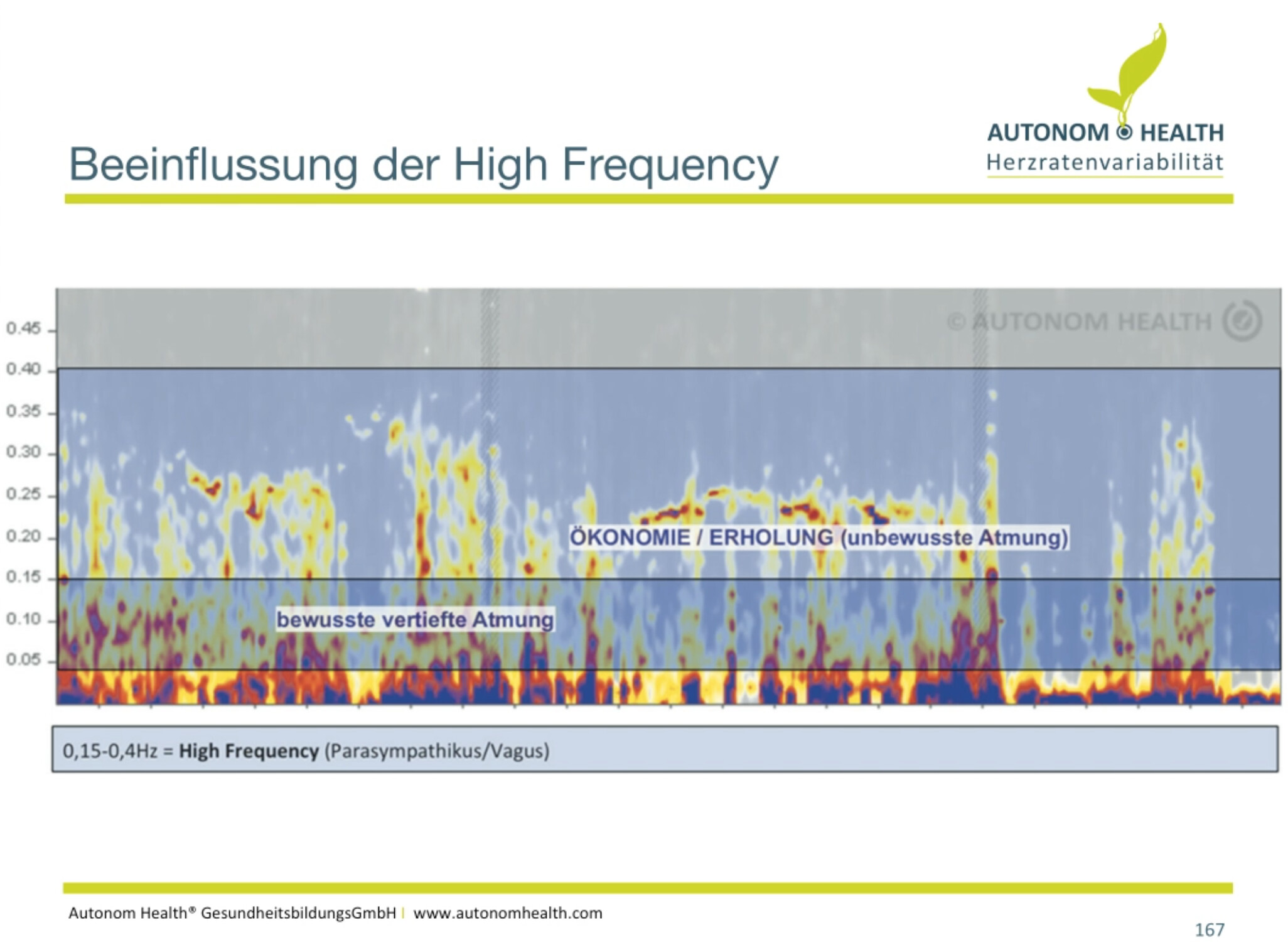 High Frequency.png