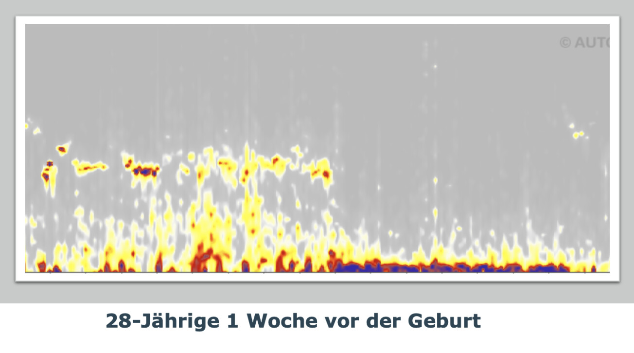 28-Jährige 1 Woche vor der Geburt.png